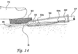 image of DSU winged needle guard from DSU Medical Corp v. JMS